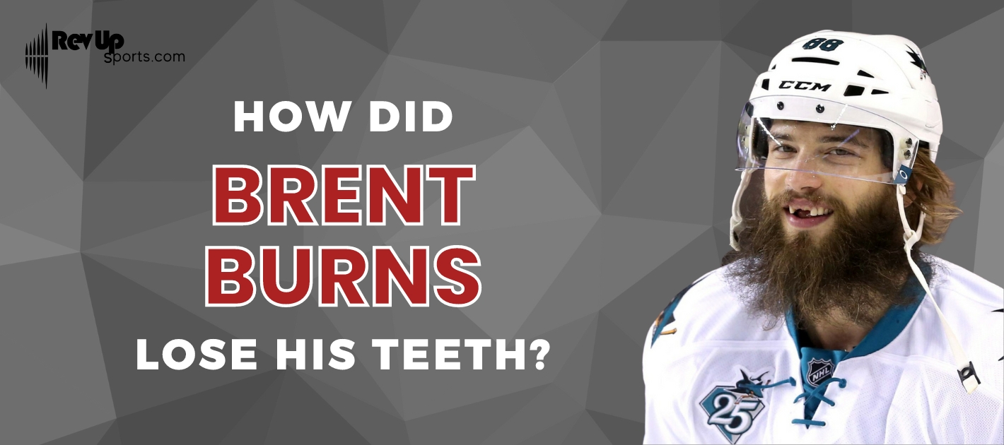 Did Brent Burns fix his teeth? : r/SanJoseSharks